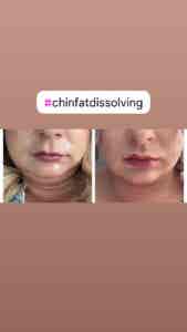 660E31E1-64DB-4F3E-A956-9FBD972AEB0E